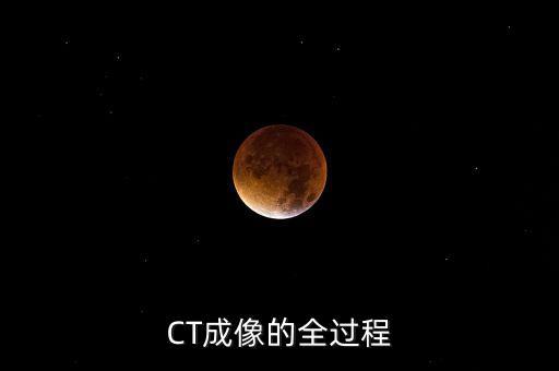ct的原理,ct和dr有何不同?